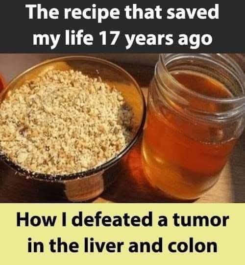 Overcame Liver and Colon Tumors 17 Years Ago With This Recipe