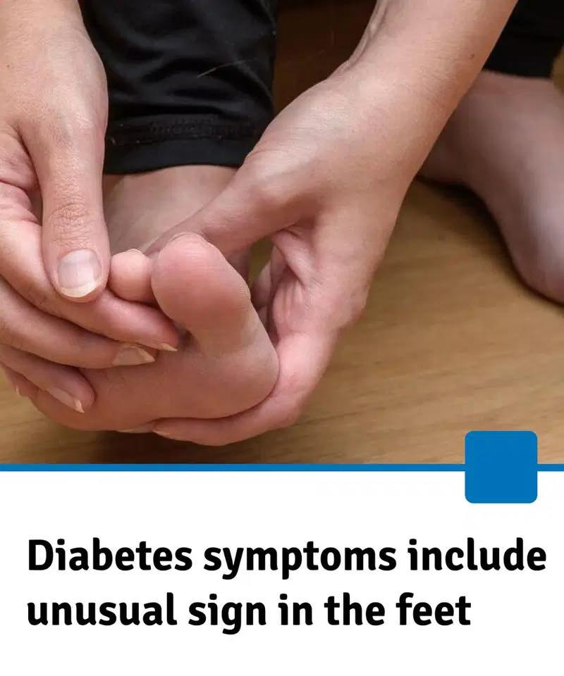 Diabetes Symptoms Can Show Up in Your Feet — Here’s How to Spot the Warning Signs