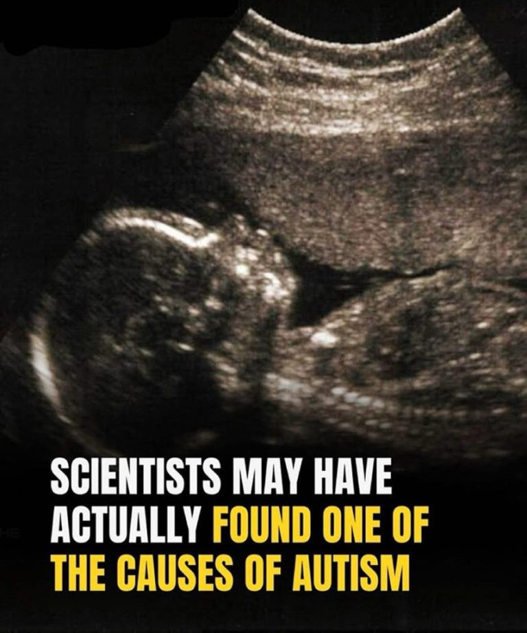 Study identifies possible connection to autism development