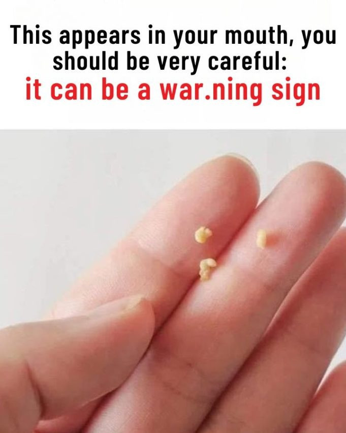 This appears in your mouth, you should be very car.eful: it can be a war.ning sign