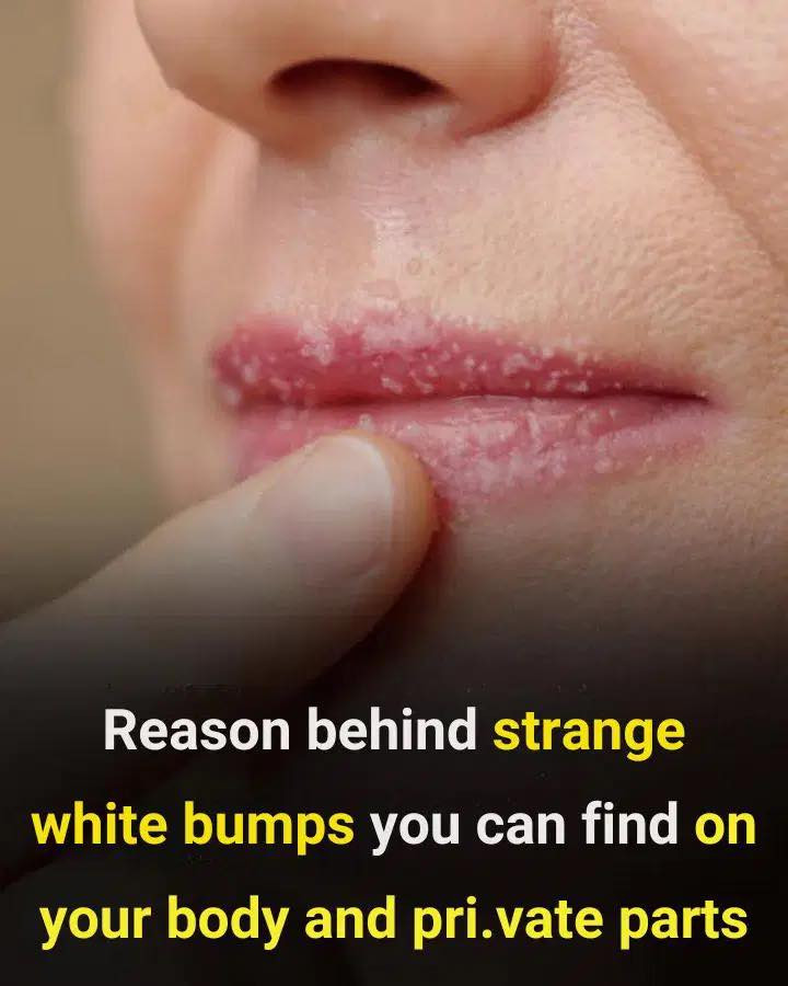 The Cause Of The Odd White Pimples On Your Your Body