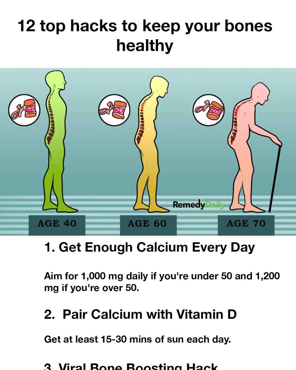 12 top hacks to keep your bones healthy