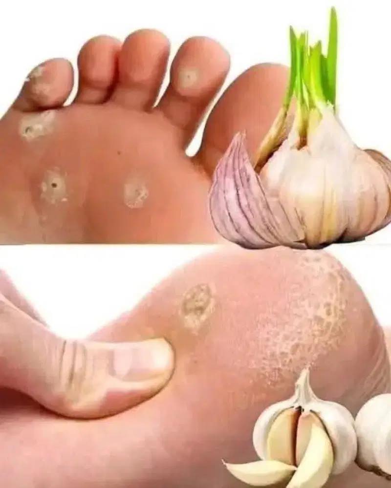 W.arning Signs on Your Feet and Natural Remedies to Care for Them