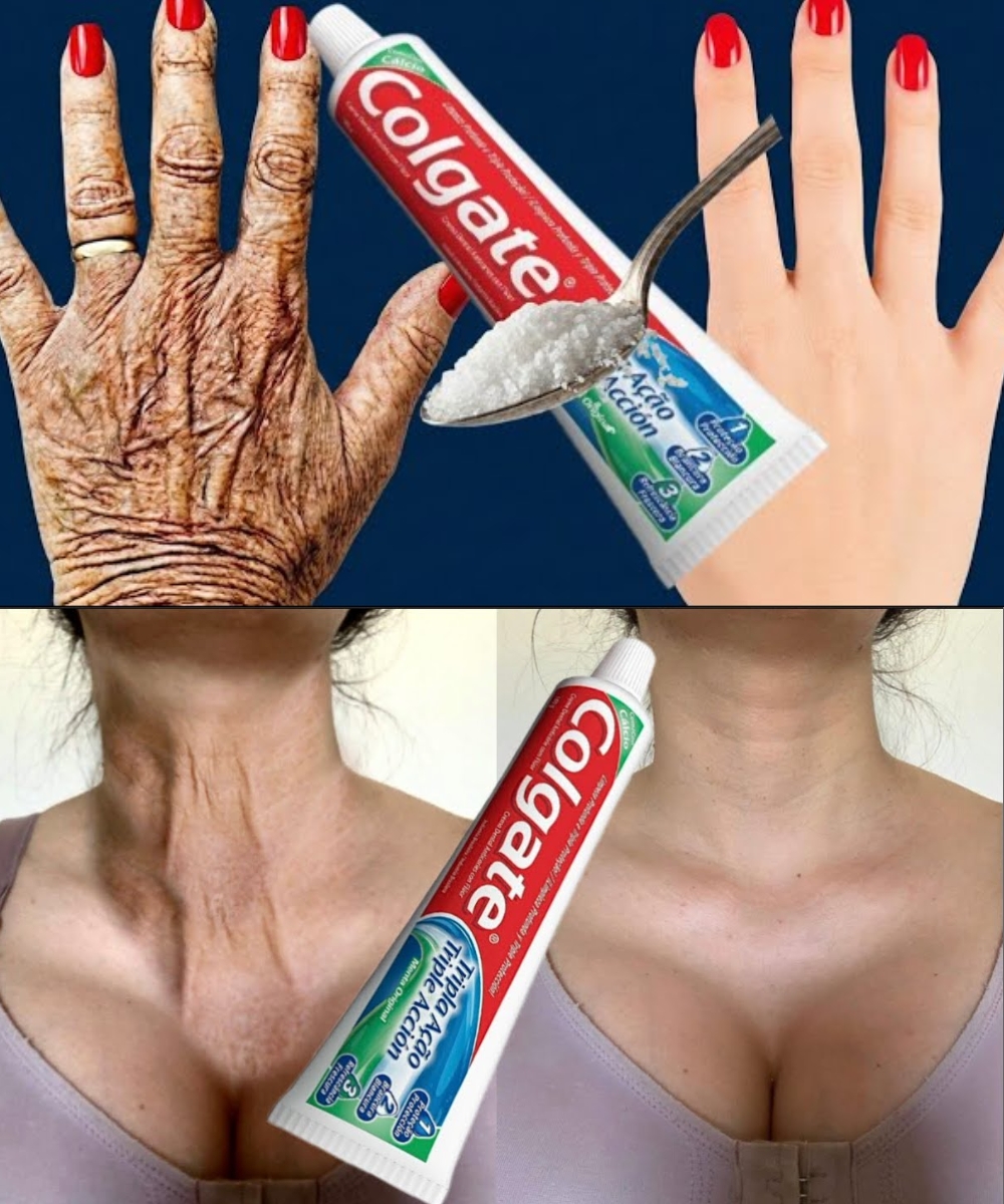 When it comes to visible signs of aging, the hands and arms are often the first places people notice changes.