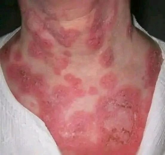 These are the consequences of sleeping with…See more