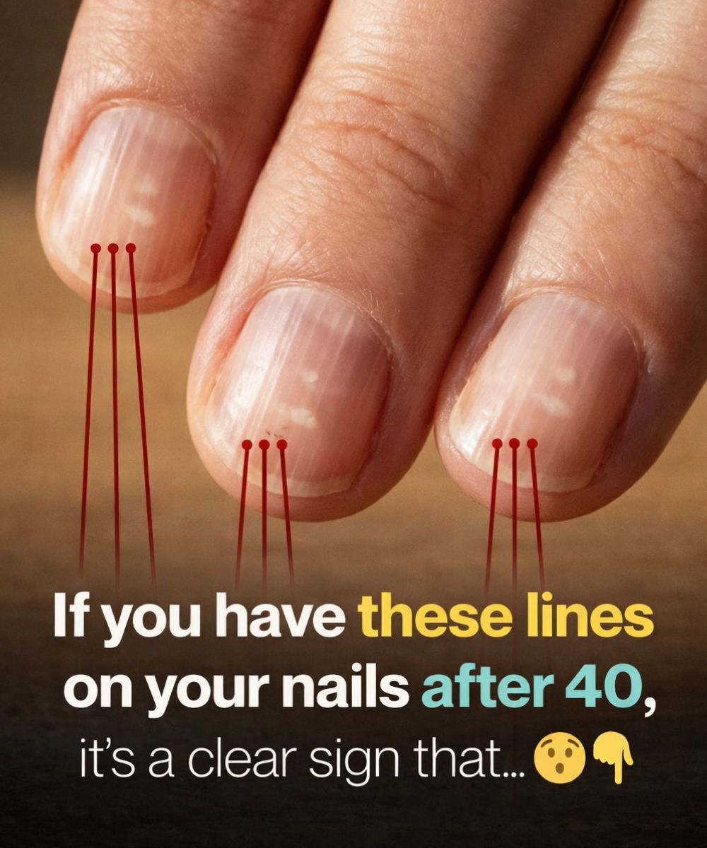 Foods That Support Stronger Nails After 40