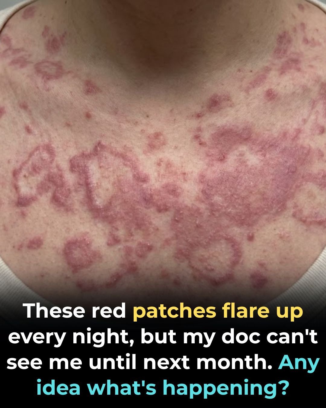 These red patches flare up every night, but my doc can’t see me until next month. Any idea what’s happening?