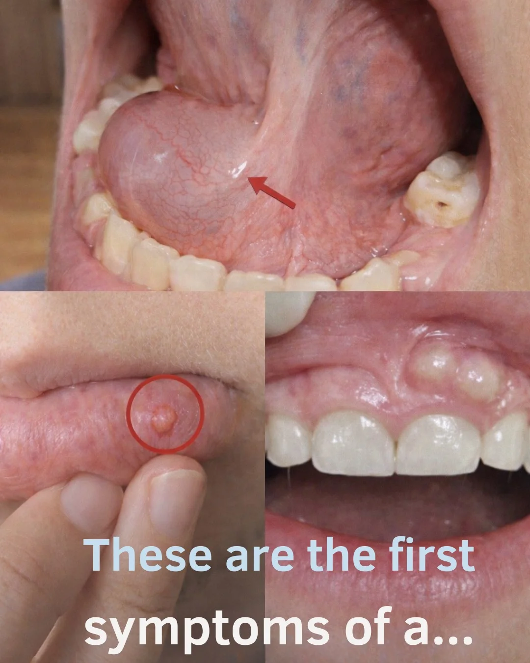 These are the first symptoms of a… 😳See more Detail in comments