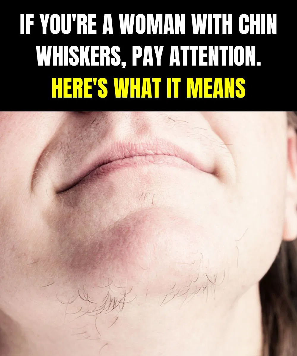 What Chin Hair in Women Really Says About Horm:ones