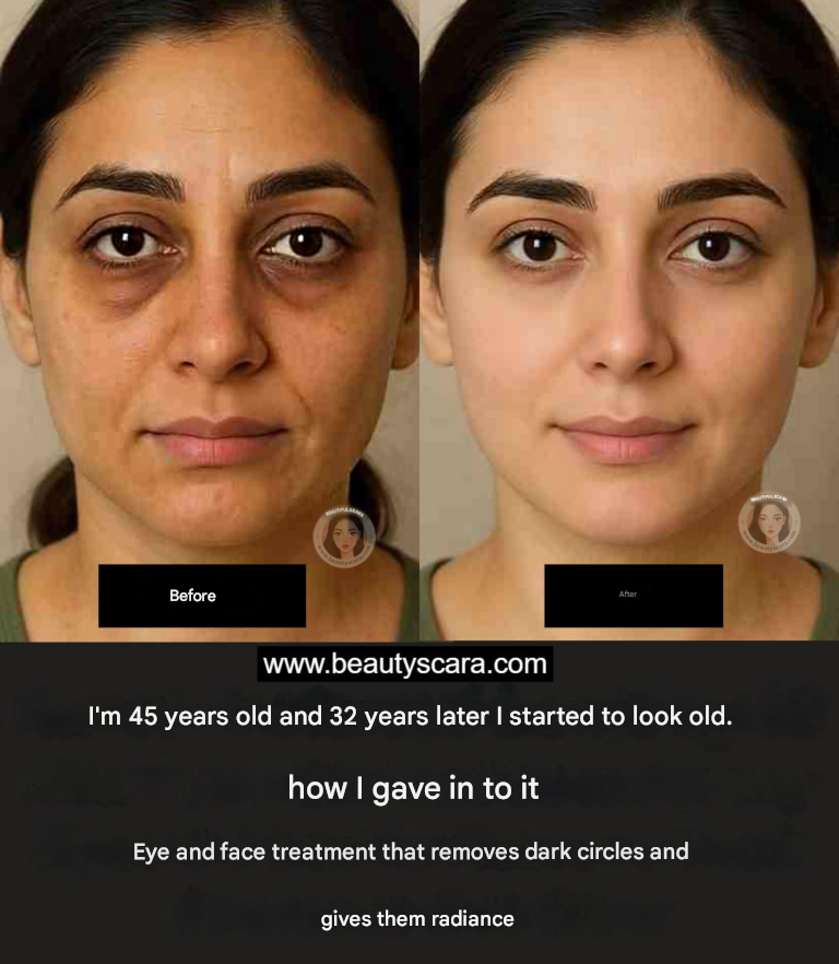 6 Coffee Masks for Dark Circles | Wrinkles Under the Eyes | Dark Circles and Puffy Eyes