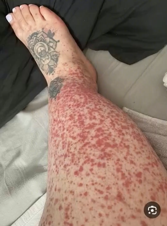 Here are the consequences of sleeping with… See more