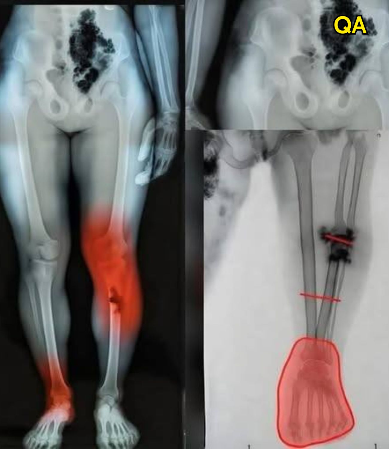 COVID-19 vaccinated individuals may be ill…See more